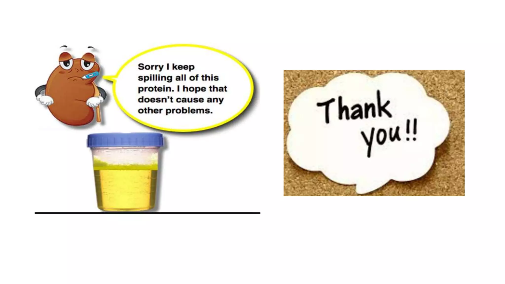 Nephrotic syndrome case presentation