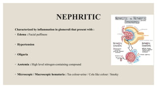 NEPHRITIC
Characterized by inflammation in glomeruli that present with :
◦ Edema : Facial puffiness
◦ Hypertension
◦ Oliguria
◦ Azotemia : High level nitrogen-containing compound
◦ Microscopic / Macroscopic hematuria : Tea colour-urine / Cola like colour / Smoky
 