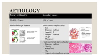 AETIOLOGY
Primary or Idiopathic Secondary causes
70-90% of cases 10% of cases
Minimal change disease Membranous nephropathy
- SLE
- Diabetes mellitus
- Hepatitis B
- Sjogren’s disease
- Drugs
- Malignany
Focal segmental glomerulosclerosis
- Diabetes mellitus
- Obesity
- Kidney loss
- HIV
- Hypertensive nephrosclerosis
 