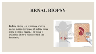 RENAL BIOPSY
Kidney biopsy is a procedure where a
doctor takes a tiny piece of kidney tissue
using a special needle. The tissue is
examined under a microscope in the
laboratory
 