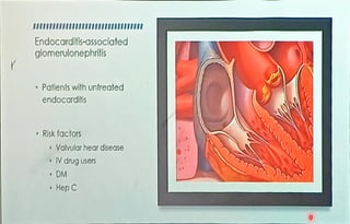 NEPHROTIC AND NEPHRITIC SYNDROME .pdf
