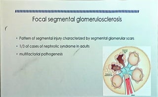 NEPHROTIC AND NEPHRITIC SYNDROME .pdf