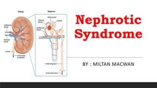 Nephrotic
Syndrome
BY : MILTAN MACWAN
 