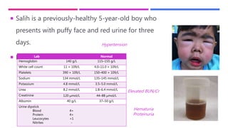  Salih is a previously-healthy 5-year-old boy who
presents with puffy face and red urine for three
days.
 His blood pressure is 125/85.
Lab Normal
Hemoglobin 140 g/L 115–155 g/L
White cell count 11 × 109/L 4.0–11.0 × 109/L
Platelets 390 × 109/L 150–400 × 109/L
Sodium 134 mmol/L 135–145 mmol/L
Potassium 4.8 mmol/L 3.5–5.0 mmol/L
Urea 8.2 mmol/L 1.8–6.4 mmol/L
Creatinine 120 μmol/L 44–88 μmol/L
Albumin 40 g/L 37–50 g/L
Urine dipstick
Blood
Protein
Leucocytes
Nitrites
4+
4+
+1
-
Elevated BUN/Cr
Hematuria
Proteinuria
Hypertension
 