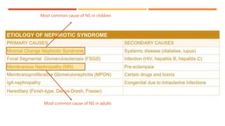 Most common cause of NS in children
Most common cause of NS in adults
 