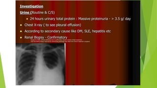 Except for SSNS, clinical deﬁnition that is sufﬁciently robust to direct initial treatment,
with the kidney biopsy reserved for identifying pathology only when the clinical response is atypical.
 