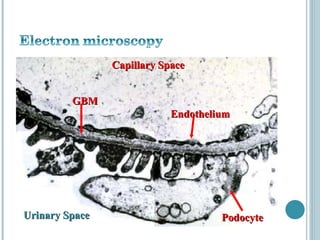 Capillary Space Endothelium Urinary Space GBM Podocyte 