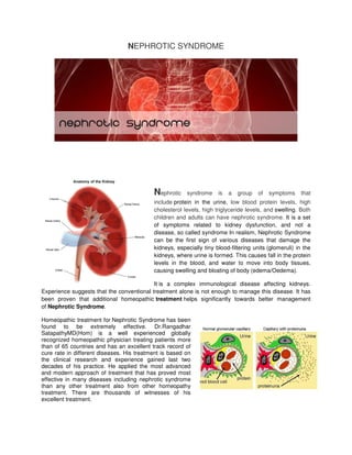 NEPHROTIC SYNDROME




                                           Nephrotic    syndrome     is   a   group   of   symptoms     that
                                           include protein in the urine, low blood protein levels, high
                                           cholesterol levels, high triglyceride levels, and swelling. Both
                                           children and adults can have nephrotic syndrome. It is a set
                                           of symptoms related to kidney dysfunction, and not a
                                           disease, so called syndrome In realism, Nephrotic Syndrome
                                           can be the first sign of various diseases that damage the
                                           kidneys, especially tiny blood-filtering units (glomeruli) in the
                                           kidneys, where urine is formed. This causes fall in the protein
                                           levels in the blood, and water to move into body tissues,
                                           causing swelling and bloating of body (edema/Oedema).

                                           It is a complex immunological disease affecting kidneys.
Experience suggests that the conventional treatment alone is not enough to manage this disease. It has
been proven that additional homeopathic treatment helps significantly towards better management
of Nephrotic Syndrome.

Homeopathic treatment for Nephrotic Syndrome has been
found to be extremely effective. Dr.Rangadhar
SatapathyMD(Hom) is a well experienced globally
recognized homeopathic physician treating patients more
than of 65 countries and has an excellent track record of
cure rate in different diseases. His treatment is based on
the clinical research and experience gained last two
decades of his practice. He applied the most advanced
and modern approach of treatment that has proved most
effective in many diseases including nephrotic syndrome
than any other treatment also from other homeopathy
treatment. There are thousands of witnesses of his
excellent treatment.
 