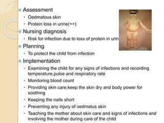  Assessment
• Oedmatous skin
• Protein loss in urine(++)
 Nursing diagnosis
• Risk for infection due to loss of protein in urine
 Planning
• To protect the child from infection
 Implementation
• Examining the child for any signs of infections and recording
temperature,pulse and respiratory rate
• Monitoring blood count
• Providing skin care,keep the skin dry and body power for
soothing
• Keeping the nails short
• Preventing any injury of oedmatus skin
• Teaching the mother about skin care and signs of infections and
involving the mother during care of the child
 