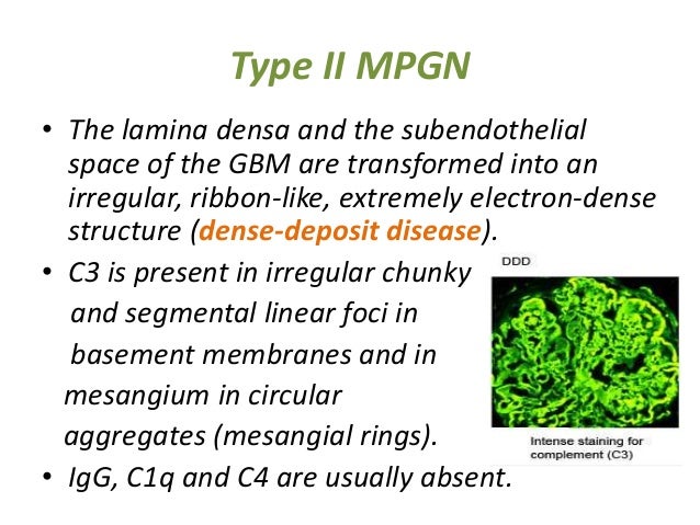 nephrotic syndrome 24 638