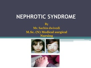 NEPHROTIC SYNDROME
By
Mr. Sachin dwivedi
M.Sc. (N) Medical surgical
Nursing
 