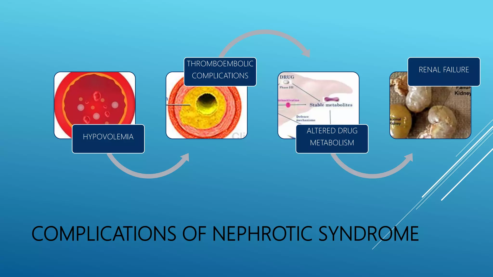 Nephrotic Syndrome PPT Nephrotic Syndrome PPT