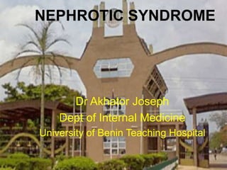 Dr Akhator Joseph
Dept of Internal Medicine
University of Benin Teaching Hospital
NEPHROTIC SYNDROME
 