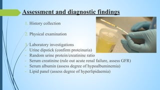 Assessment and diagnostic findings
1. History collection
2. Physical examination
3. Laboratory investigations
- Urine dipstick (confirm proteinuria)
- Random urine protein/creatinine ratio
- Serum creatinine (rule out acute renal failure, assess GFR)
- Serum albumin (assess degree of hypoalbuminemia)
- Lipid panel (assess degree of hyperlipidaemia)
 