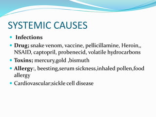 SYSTEMIC CAUSES
 Infections
 Drug; snake venom, vaccine, pellicillamine, Heroin,,
NSAID, captopril, probenecid, volatile hydrocarbons
 Toxins; mercury,gold ,bismuth
 Allergy:, beesting,serum sickness,inhaled pollen,food
allergy
 Cardiovascular;sickle cell disease
 