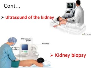  Ultrasound of the kidney
Cont…
 Kidney biopsy
 