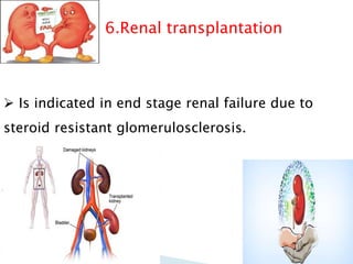 6.Renal transplantation
 Is indicated in end stage renal failure due to
steroid resistant glomerulosclerosis.
 