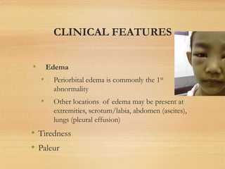 CLINICAL FEATURES
• Edema
• Periorbital edema is commonly the 1st
abnormality
• Other locations of edema may be present at
extremities, scrotum/labia, abdomen (ascites),
lungs (pleural effusion)
• Tiredness
• Paleur
 