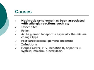 Causes
 Nephrotic syndrome has been associated
with allergic reactions such as;
 Insect bites
 Pollen
 Acute glomerulonephritis especially the minimal
change type
 Post-streptococcal glomerulonephritis
 Infections
 Herpes zoster, HIV, hepatitis B, hepatitis C,
syphilis, malaria, tuberculosis.
 