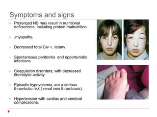 Symptoms and signs 
 Prolonged NS may result in nutritional 
deficiencies, including protein malnutrition 
 ,myopathy, 
 Decreased total Ca++, tetany 
 Spontaneous peritonitis and opportunistic 
infections 
 Coagulation disorders, with decreased 
fibrinolytic activity 
 Episodic hypovolemia, are a serious 
thrombotic risk ( renal vein thrombosis). 
 Hypertension with cardiac and cerebral 
complications. 
 