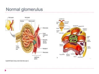 Normal glomerulus 
 