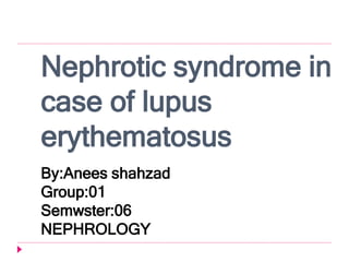 Nephrotic syndrome in
case of lupus
erythematosus
By:Anees shahzad
Group:01
Semwster:06
NEPHROLOGY
 
