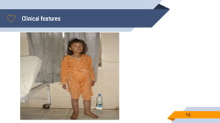 Clinical features
12.
▰.
 