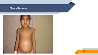 Clinical features
14.
▰.
 