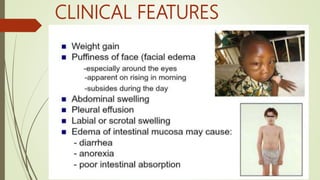CLINICAL FEATURES
 