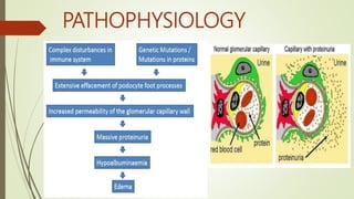 PATHOPHYSIOLOGY
 