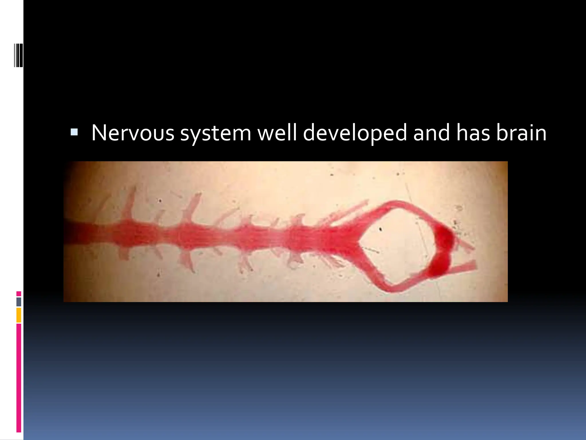  Nervous system well developed and has brain
 