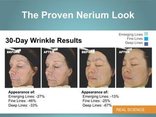 The Proven Nerium Look
                                                  Emerging Lines
                                                      Fine Lines
30-Day Wrinkle Results                               Deep Lines

BEFORE             AFTER   BEFORE                 AFTER




Appearance of:             Appearance of:
Emerging Lines: -27%       Emerging Lines: -13%
Fine Lines: -46%           Fine Lines: -25%
Deep Lines: -33%           Deep Lines: -67%
                                             REAL SCIENCE
 