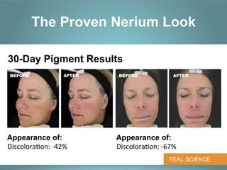 The Proven Nerium Look

30-Day Pigment Results
 BEFORE              AFTER    BEFORE              AFTER




Appearance of:               Appearance of:
Discolora*on:	
  -­‐42%      Discolora*on:	
  -­‐67%
                                                 REAL SCIENCE
 