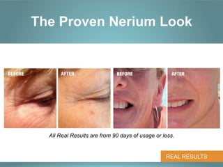 The Proven Nerium Look


                             BEFORE                AFTER




  All Real Results are from 90 days of usage or less.


                                                 REAL RESULTS
 