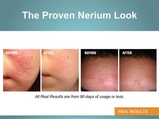 The Proven Nerium Look




  All Real Results are from 90 days of usage or less.


                                                 REAL RESULTS
 