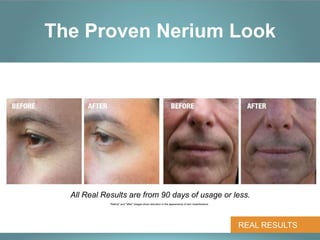 The Proven Nerium Look




  All Real Results are from 90 days of usage or less.
             "Before" and "after" images show reduction in the appearance of skin imperfections.




                                                                                                   REAL RESULTS
 