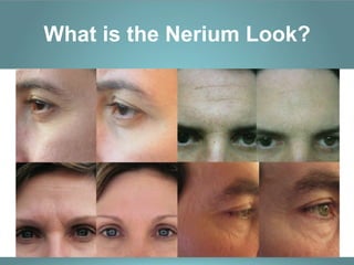 What is the Nerium Look?
 