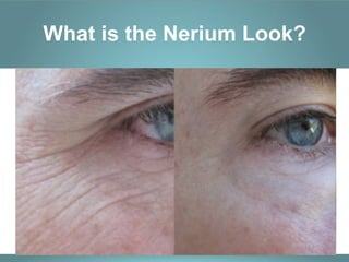 What is the Nerium Look?
 