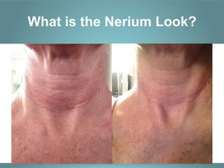 What is the Nerium Look?
 