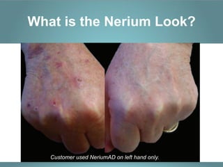 What is the Nerium Look?




   Customer used NeriumAD on left hand only.
 