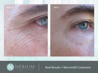 Nerium before and after results