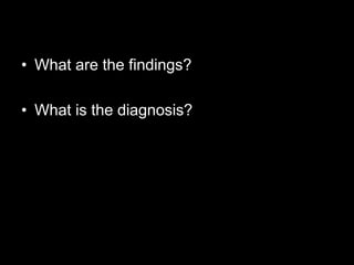 • What are the findings?

• What is the diagnosis?
 