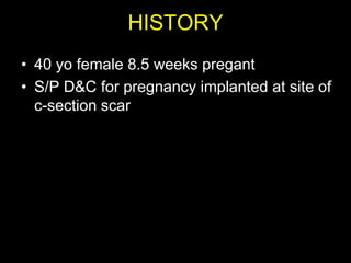 HISTORY
• 40 yo female 8.5 weeks pregant
• S/P D&C for pregnancy implanted at site of
  c-section scar
 