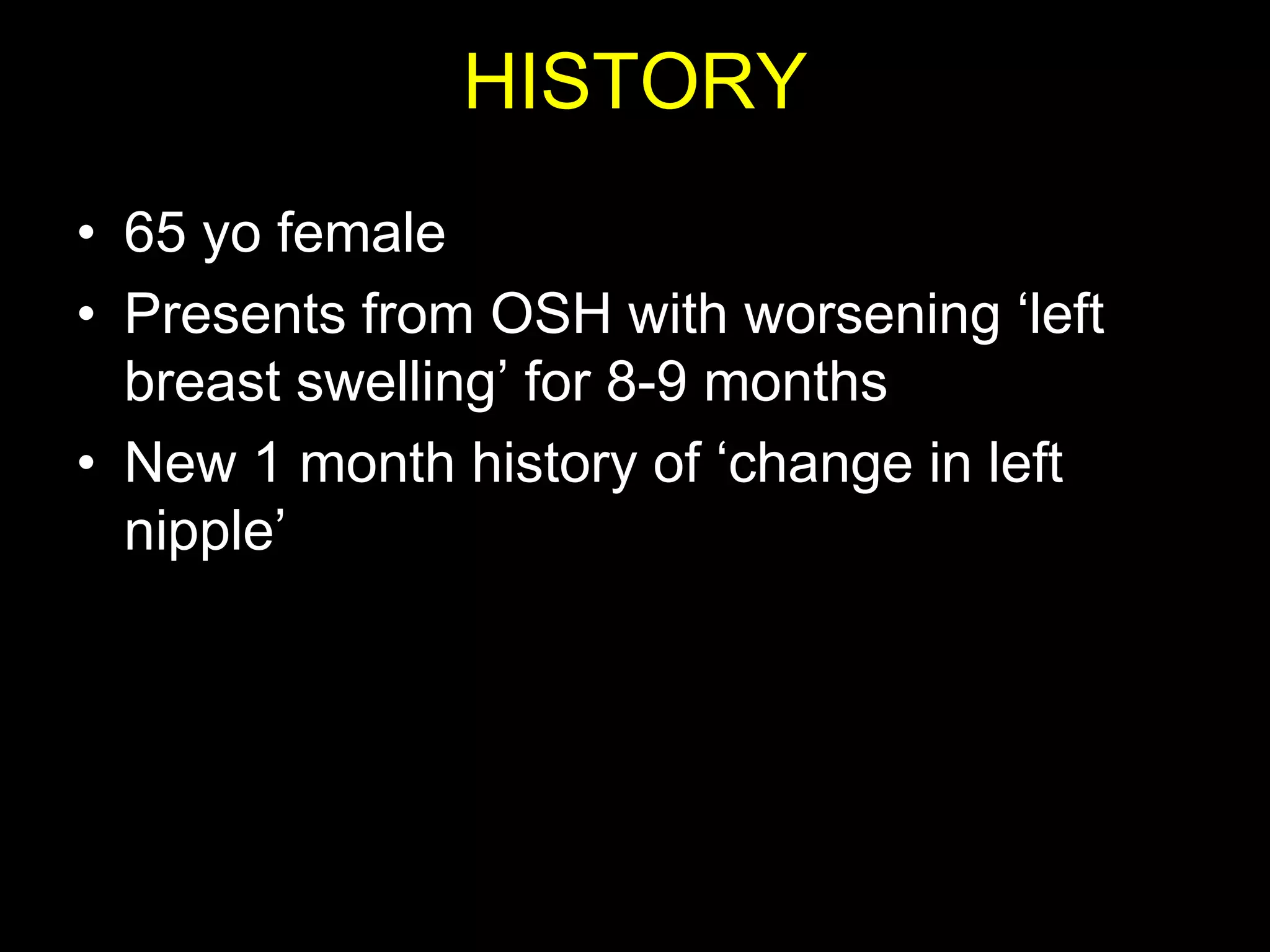 HISTORY
• 65 yo female
• Presents from OSH with worsening „left
  breast swelling‟ for 8-9 months
• New 1 month history of „change in left
  nipple‟
 