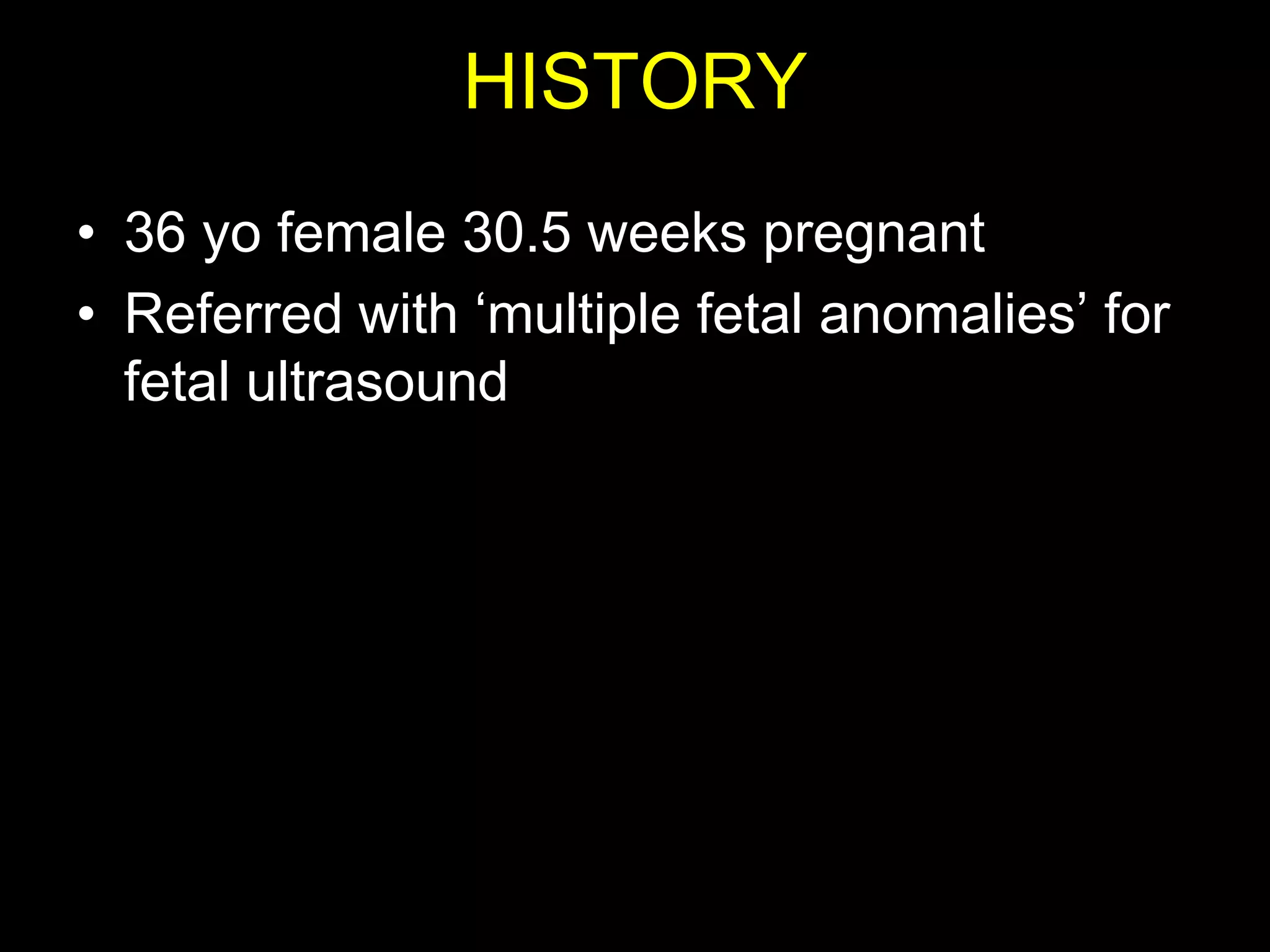 HISTORY
• 36 yo female 30.5 weeks pregnant
• Referred with „multiple fetal anomalies‟ for
  fetal ultrasound
 
