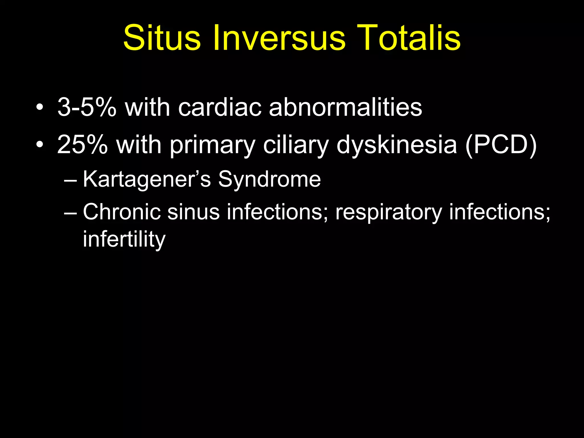 Situs Inversus Totalis
• 3-5% with cardiac abnormalities
• 25% with primary ciliary dyskinesia (PCD)
  – Kartagener‟s Syndrome
  – Chronic sinus infections; respiratory infections;
    infertility
 