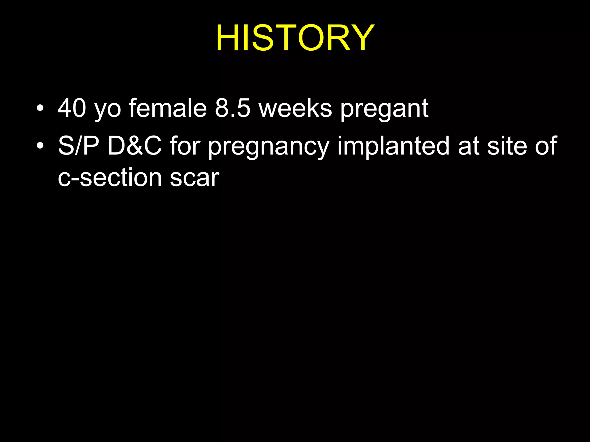 HISTORY
• 40 yo female 8.5 weeks pregant
• S/P D&C for pregnancy implanted at site of
  c-section scar
 