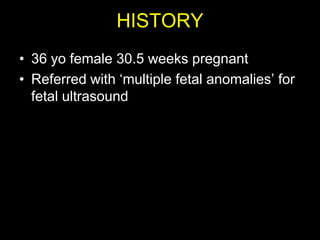 HISTORY
• 36 yo female 30.5 weeks pregnant
• Referred with „multiple fetal anomalies‟ for
  fetal ultrasound
 
