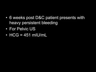 • 6 weeks post D&C patient presents with
  heavy persistent bleeding
• For Pelvic US
• HCG = 451 mIU/mL
 