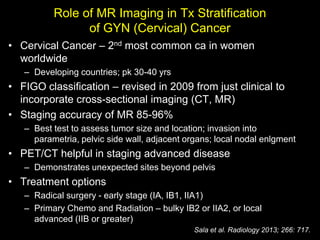 Role of MR Imaging in Tx Stratification
                of GYN (Cervical) Cancer
• Cervical Cancer – 2nd most common ca in women
  worldwide
   – Developing countries; pk 30-40 yrs
• FIGO classification – revised in 2009 from just clinical to
  incorporate cross-sectional imaging (CT, MR)
• Staging accuracy of MR 85-96%
   – Best test to assess tumor size and location; invasion into
     parametria, pelvic side wall, adjacent organs; local nodal enlgment
• PET/CT helpful in staging advanced disease
   – Demonstrates unexpected sites beyond pelvis
• Treatment options
   – Radical surgery - early stage (IA, IB1, IIA1)
   – Primary Chemo and Radiation – bulky IB2 or IIA2, or local
     advanced (IIB or greater)
                                              Sala et al. Radiology 2013; 266: 717.
 